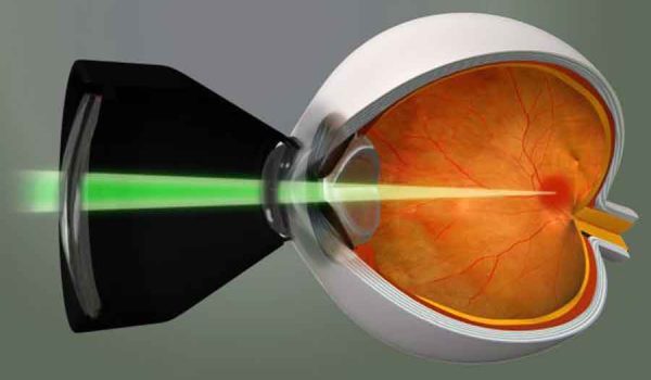 Laser_V06